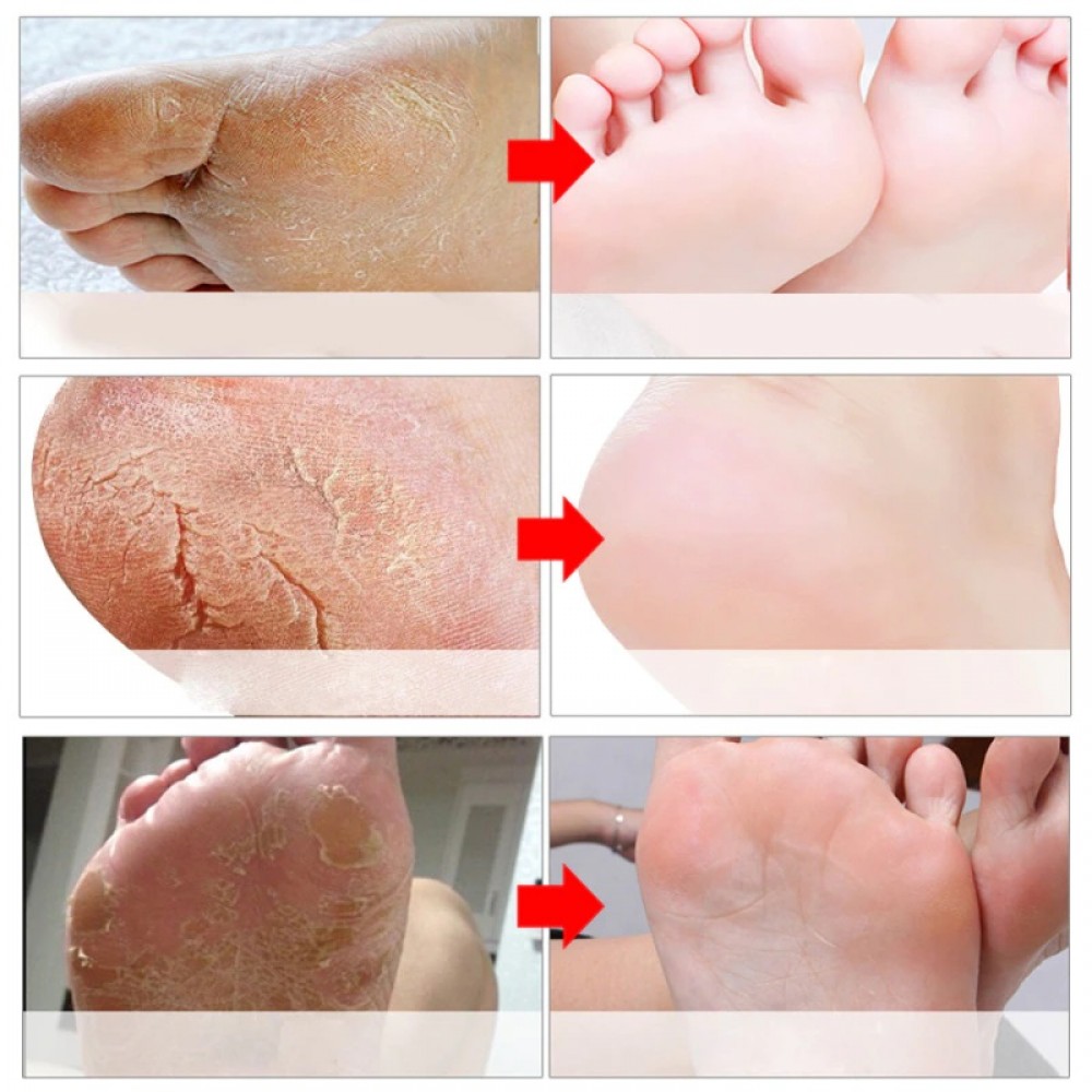 Putimi Çorap Tipi Ayak Peeling Maskesi